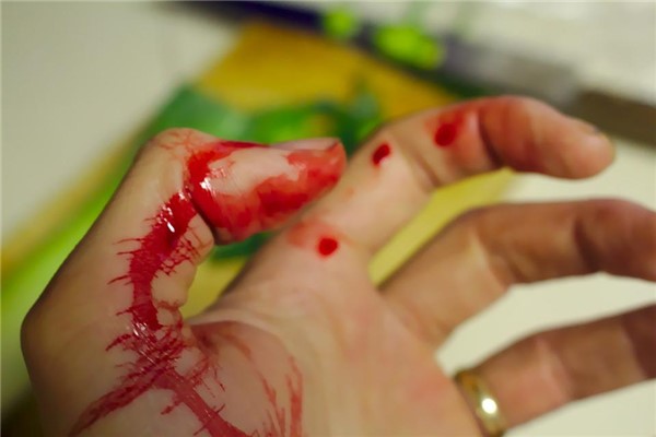 女生手割伤照片流血图片
